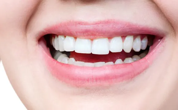 braces-before-2