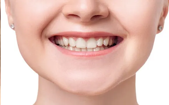 dental-implant-after