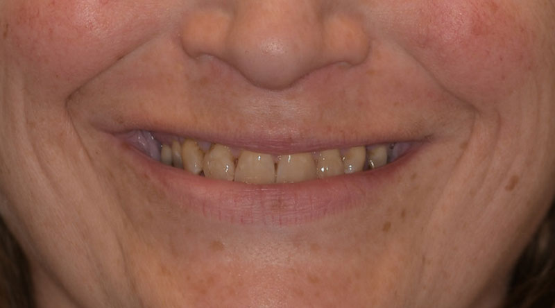 Kelli-upclose-before Kelli-upclose-before