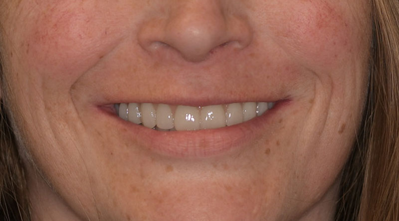 kelli-closeup-after-