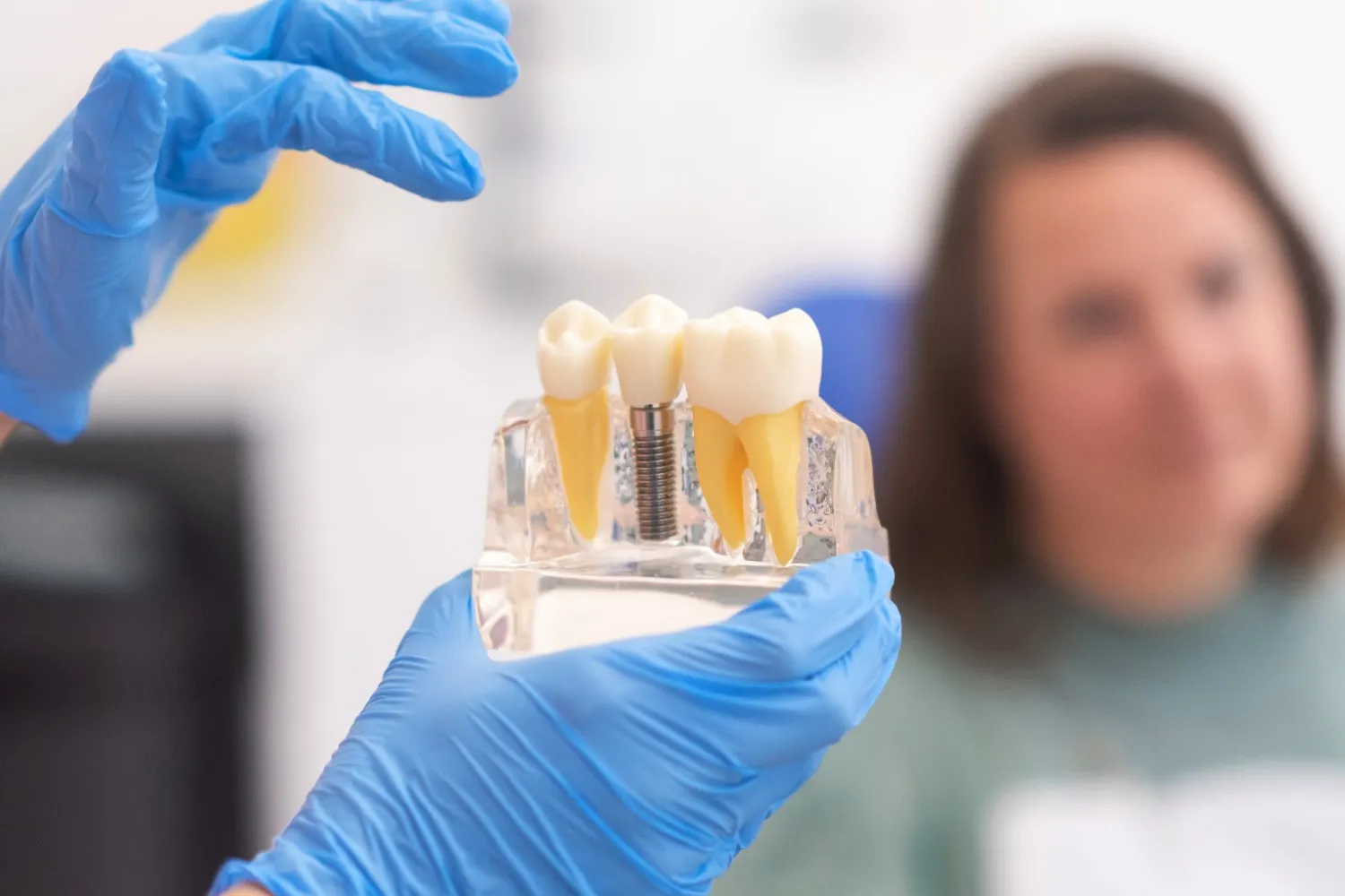 Dental Implants More Cost