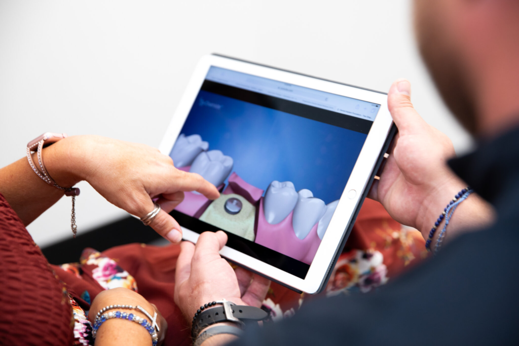 Financing for Dental Implants